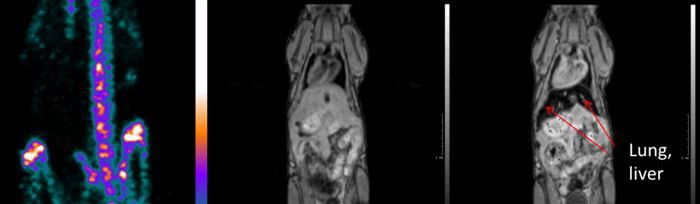 Dual-modality MRI and PET nanoparticle agents